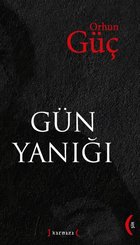 Gün Yanığı