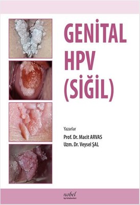 Genital HPV (Siğil)