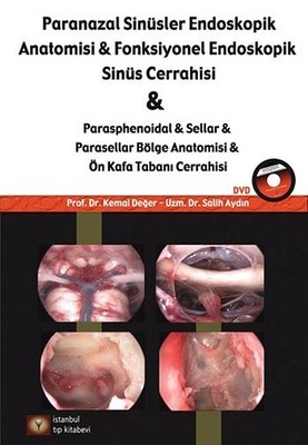 Paranazal Sinüsler Endoskopik Anatomisi ve Fonksiyonel Endoskopik Sinüs Cerrahisi