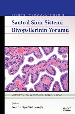 Biyopsilerin Yorumu: Santral Sinir Sistemi