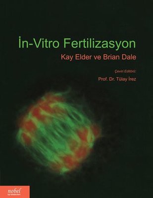 İn - Vitro Fertilizasyon