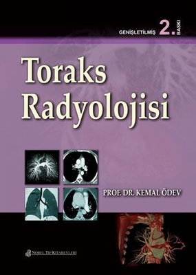 Toraks Radyolojisi