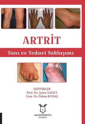 Artrit - Tanı ve Tedavi Yaklaşımı