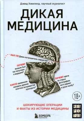 Dikaya meditsina. Shokiruyushchiye operatsii i fakty iz istorii meditsiny