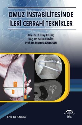 Omuz İnstabilitesinde İleri Cerrahi Teknikler