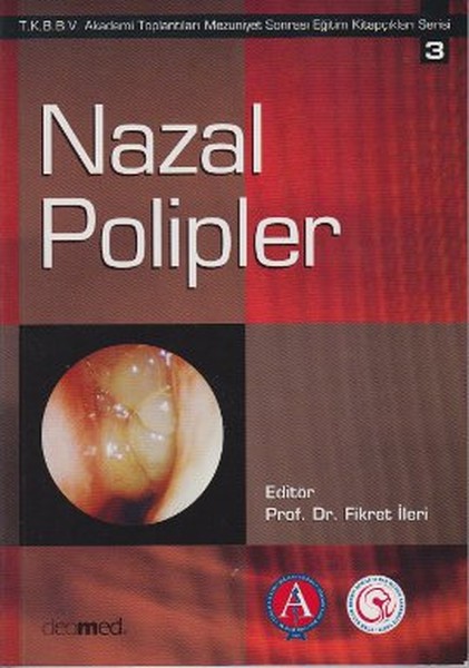 Nazal Polipler