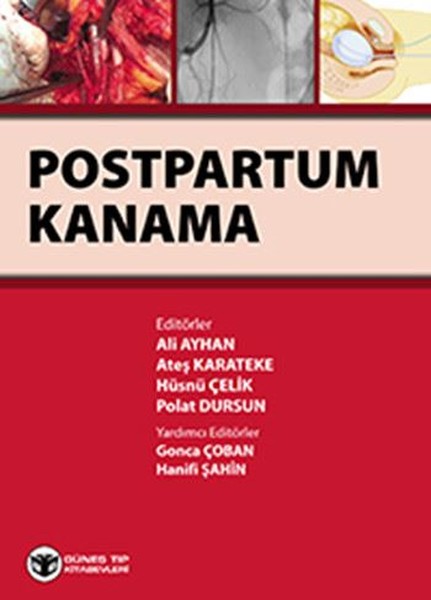 Postpartum Kanama