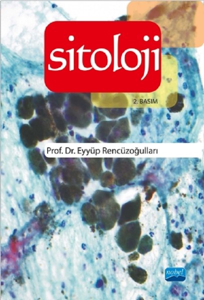 Sitoloji