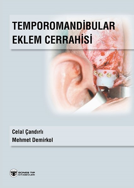 Temporomandibular Eklem Cerrahisi