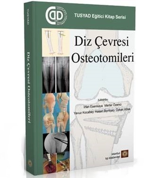 Diz Çevresi Osteotomileri