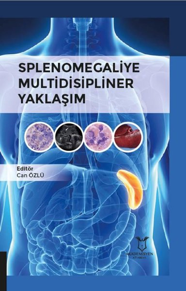 Splenomegaliye Multidisipliner Yaklaşım