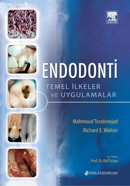 Endodonti Temel İlke ve Uygulamalar