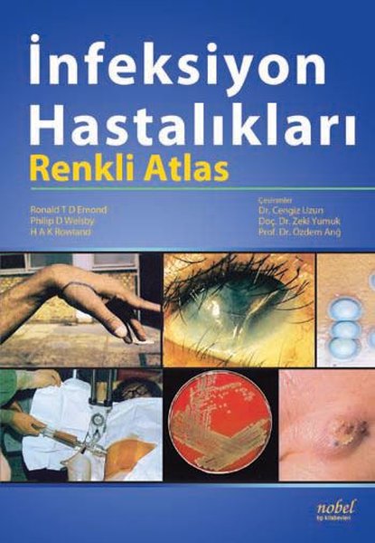 İnfeksiyon Hastalıkları Renkli Atlası