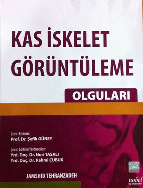 Kas İskelet Görüntüleme Olguları