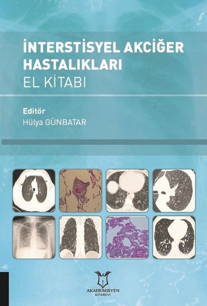 İnterstisyel Akciğer Hastalıkları El Kitabı