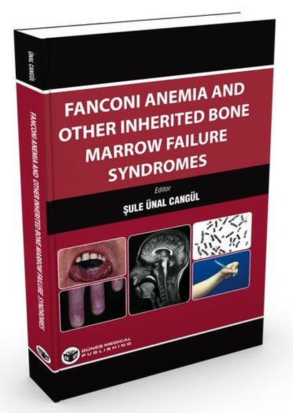 Fanconi Anemia and Other Inherited Bone Marrow Failure Syndromes