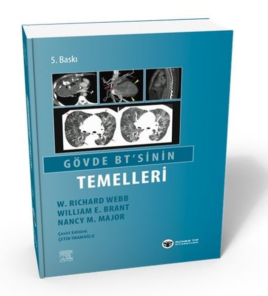 Gövde BT'sinin Temelleri