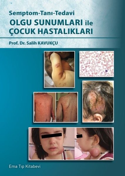 Olgu Sunumları ile Çocuk Hastalıkları - Semptom - Tanı - Tedavi