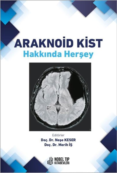 Araknoid Kist Hakkında Herşey