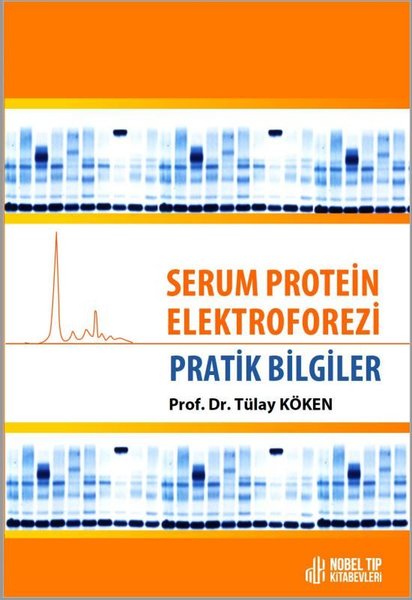 Serum Protein Elektroforezi - Pratik Bilgiler