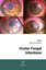 Ocular Fungal Infections